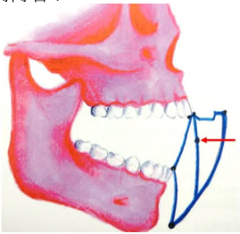  正中咬合（ central occlusion ）  後縮接觸位（ retruded contact position ）