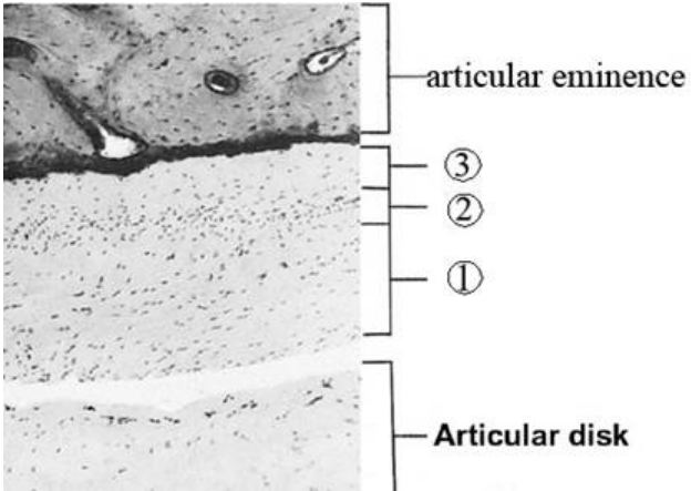A. 纖維軟骨( fibrocartilage )、緻密纖維組織( dense fibrous tissue )、增殖區 ( proliferative zone )