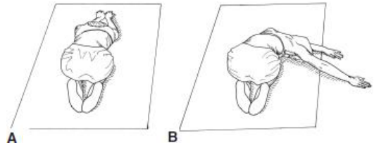 A. 可用來治療右胸椎側彎( right thoracic curve )的患者