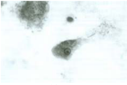  ciprofloxacin