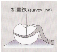  固位臂