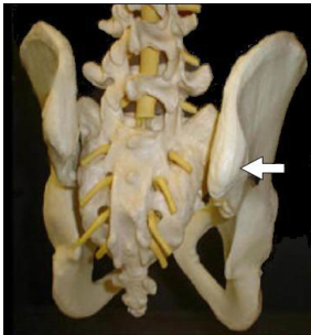  髂後上棘( posterior superior iliac spine ) 髂棘( iliac crest )