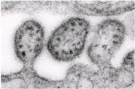 72. 下列有關一般實驗室檢測冠狀病毒( coronavirus )之敘述,何者錯誤?