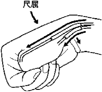  又稱 de Quervain 腱鞘炎 伸拇短肌受侵犯