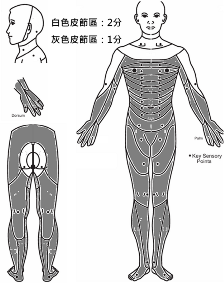 A.ASIA C,神經節為 C5,臨床表現符合前髓症候群