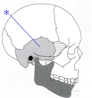  額骨( frontal bone ) 上顎骨( maxilla )