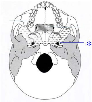  上顎骨( maxilla ) 額骨( frontal bone )