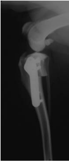 A.TPLO ( tibial plateau leveling osteotomy )