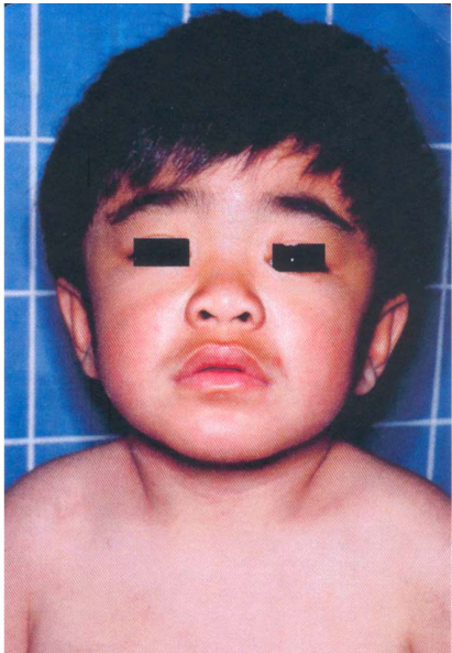  腦波檢查